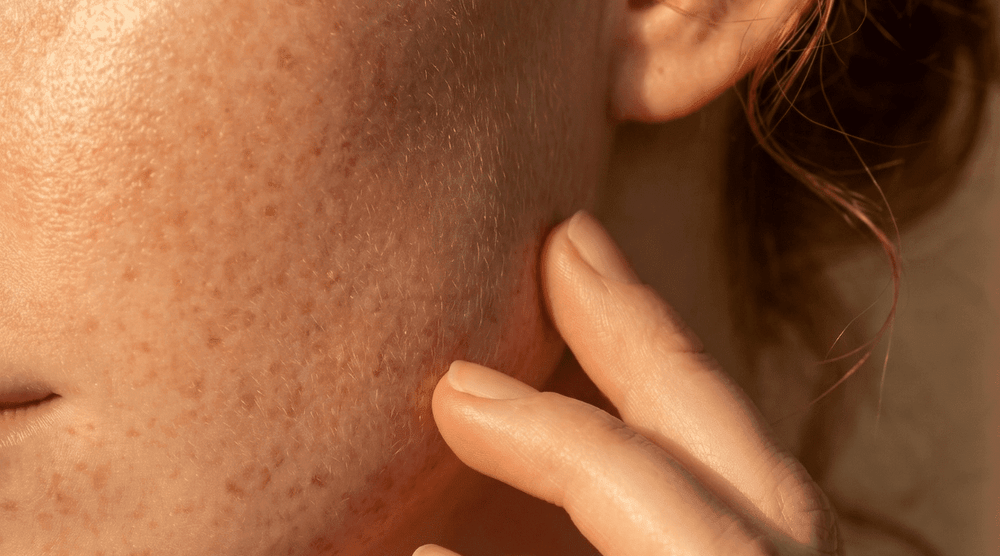 What Is Collagen (and Why Does it Decline With Age?)