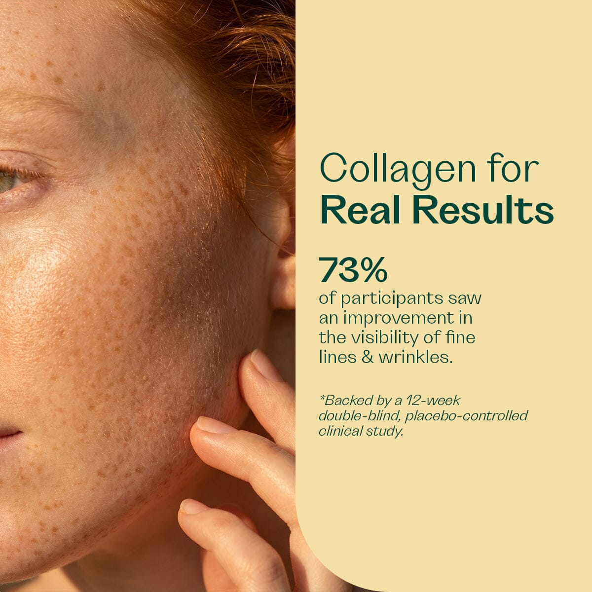 Collagen Peptides Collagen (New) Rheal 